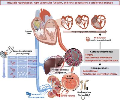 Tricuspid regurgitation, right ventricular function, and renal congestion: a cardiorenal triangle